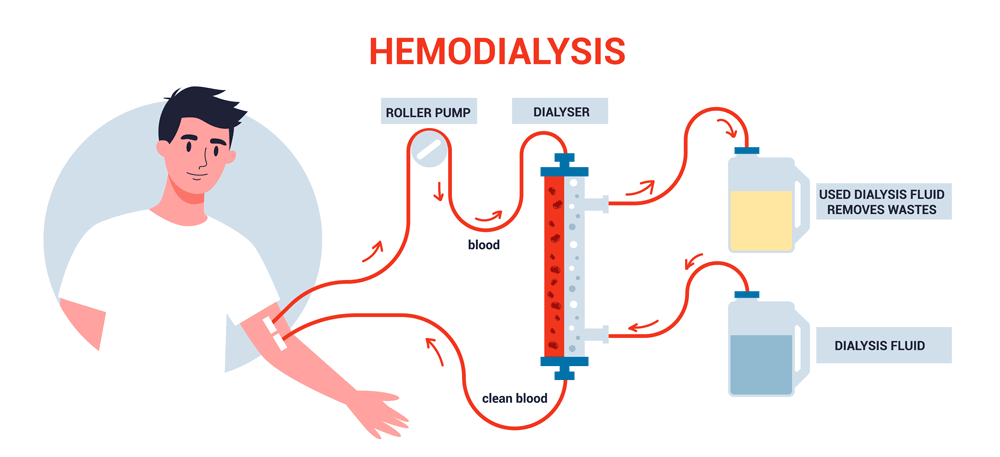 Hemodialysis